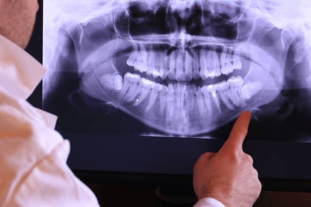 Best Emergency Dentist for Lost Fillings or Crowns in Madisonville, TN