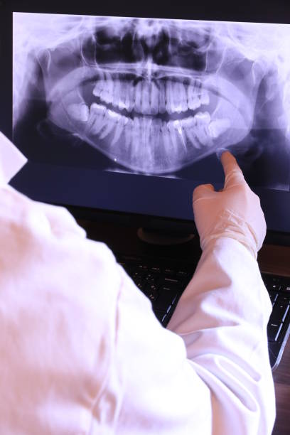 Best Emergency Dentist for Knocked-Out Tooth in Madisonville, TN