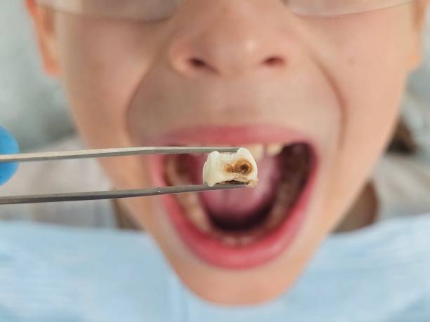 Best Holiday Emergency Dentist in Madisonville, TN